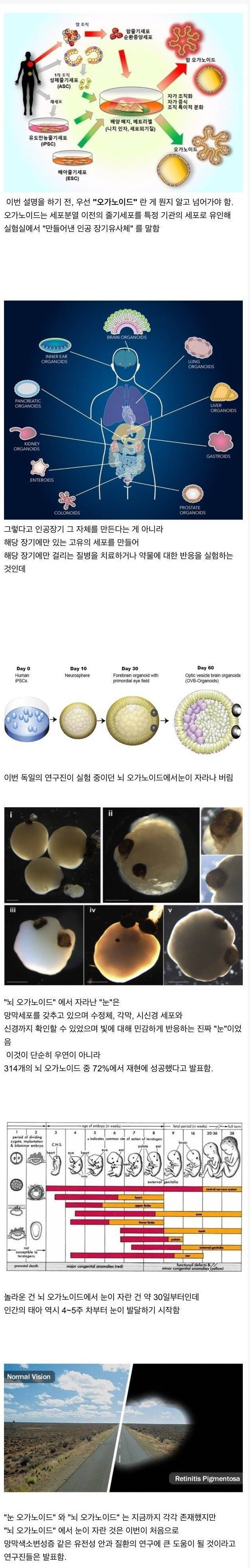 인공 뇌에서 실제 인간의 눈이 생성