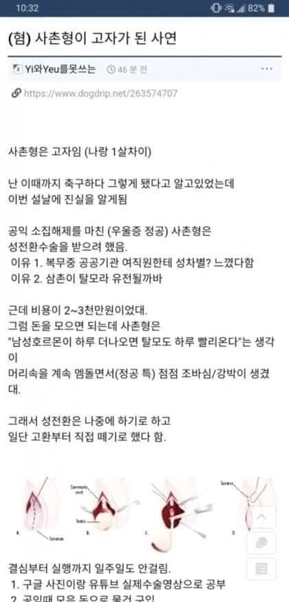 스스로 고환 적출하고 고자가 된 사촌형 썰 