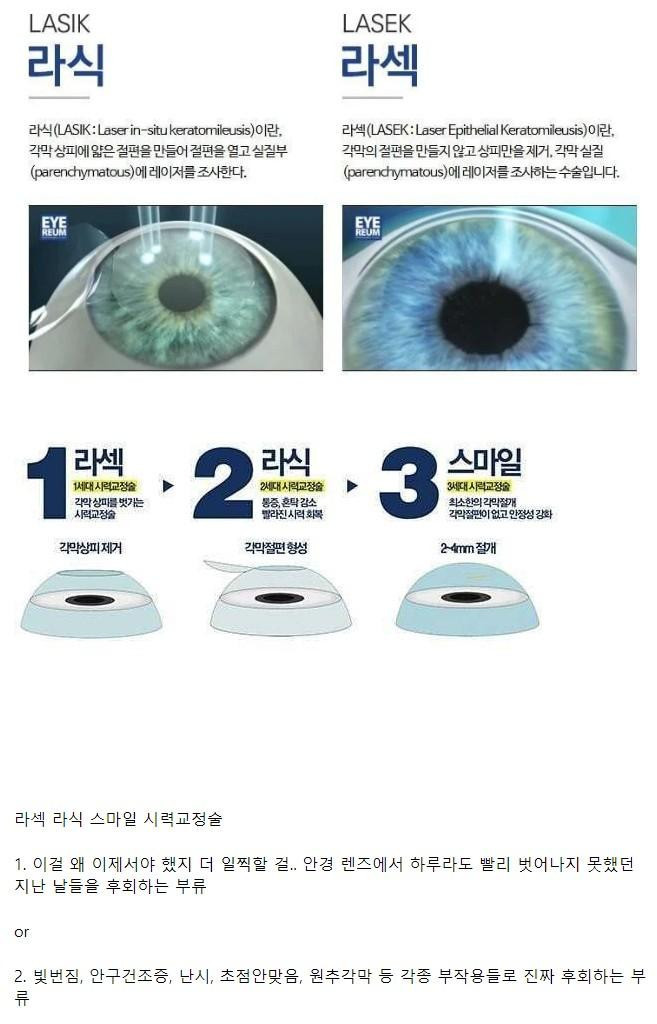 한 사람들은 대부분 후회한다는 수술